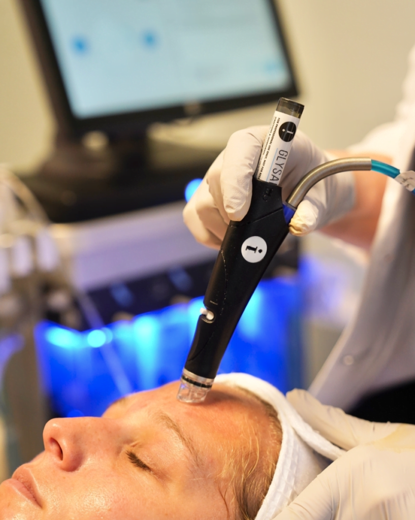 Hydrafacial treatment