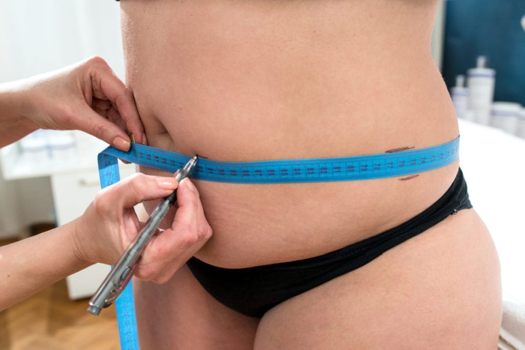 Woman getting measurements taken by doctor at medical weight loss check-in appointment